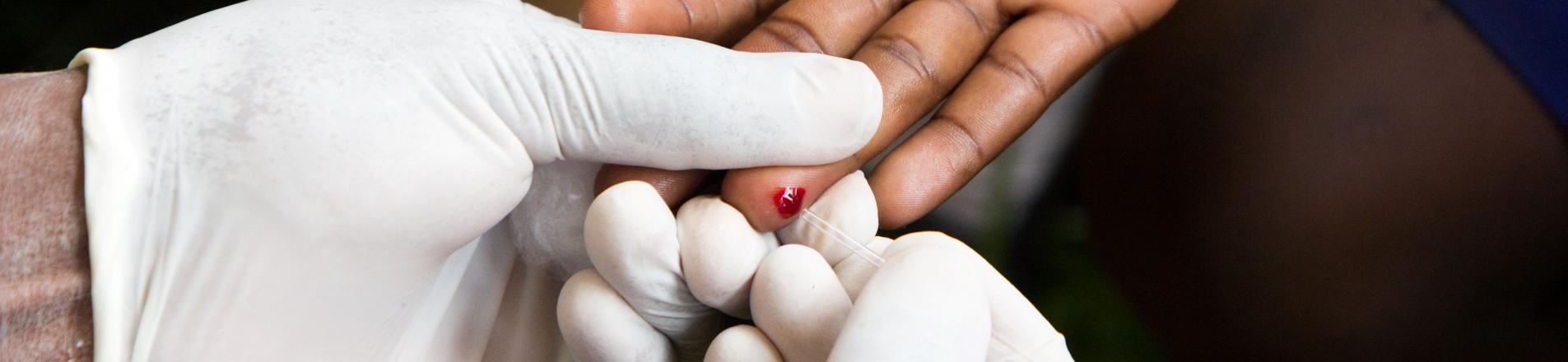 social stigma around HIV AIDS and testing